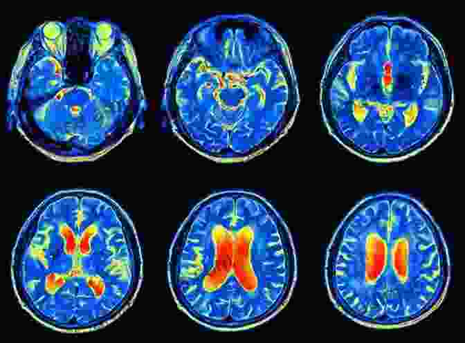 A Brain Scan Of A Person With A Distorted And Sinister Expression, Representing The Psychological Complexities Behind Heinous Crimes Murder Most Vile Volume 2: 18 Shocking True Crime Murder Cases