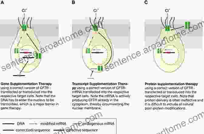 A Graphic Illustrating Gene Therapy As A Potential Treatment For CF Kids With Cystic Fibrosis: A Great Role Model For Children With Cystic Fibrosis: Update On Key Emerging Challenges In Cystic Fibrosis