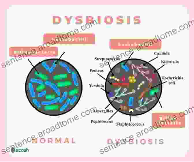 An Illustration Of Disrupted Microbial Balance (dysbiosis) In The CF Microbiome Kids With Cystic Fibrosis: A Great Role Model For Children With Cystic Fibrosis: Update On Key Emerging Challenges In Cystic Fibrosis