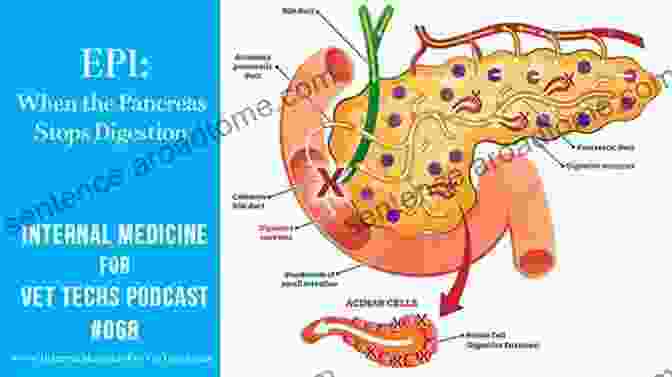 An Illustration Of The Pancreas With Impaired Exocrine Function In EPI Kids With Cystic Fibrosis: A Great Role Model For Children With Cystic Fibrosis: Update On Key Emerging Challenges In Cystic Fibrosis