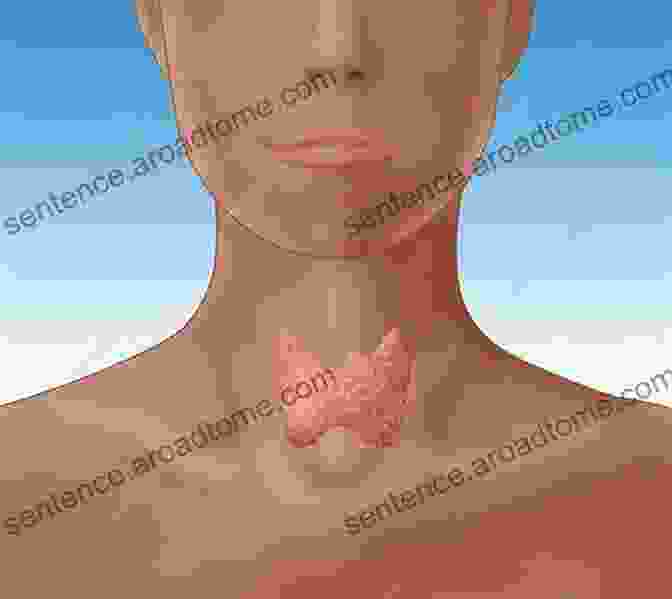 An Image Of The Thyroid Gland, Located In The Front Of The Neck Thyroid Hormones And The Tests That Monitor Them