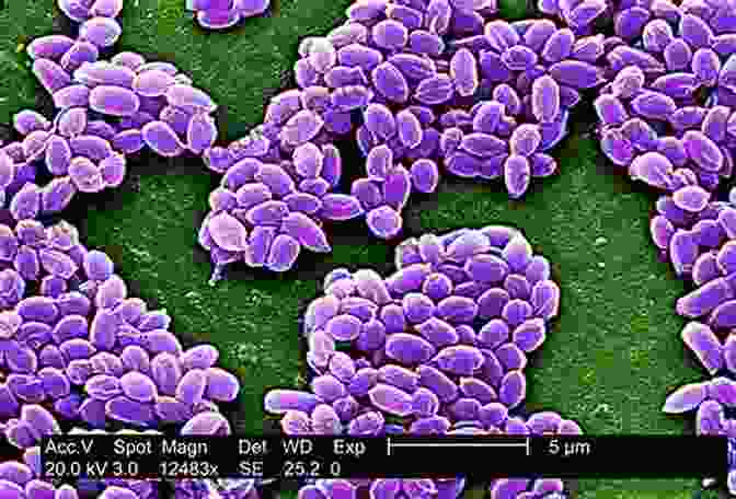 Anthrax Spores Visualized Under A Microscope, Providing Clues To Their Origin Anthrax: The Investigation Of A Deadly Outbreak