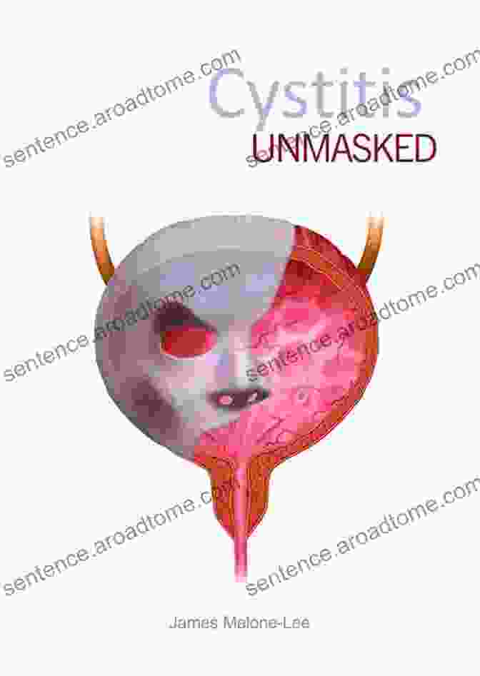 Cystitis Unmasked Book Cover Cystitis Unmasked James Malone Lee