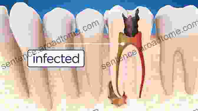 Pediatric Dentist Performing A Root Canal Treatment On A Child's Tooth Handbook Of Clinical Techniques In Pediatric Dentistry