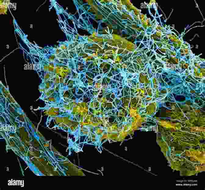 Scanning Electron Micrograph Of An Ebola Virus Particle Ebola: An Evolving Story James Lyons Weiler