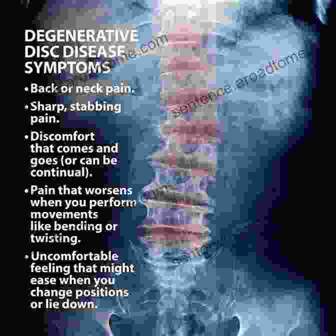 Time Saving Natural Solutions For Back Neck Pain Spinal Degeneration And The POSTURE HANDBOOK For People Who Sit Frequently: Time Saving Natural Solutions For Back Neck Pain Spinal Degeneration And Decreased Energy Focus