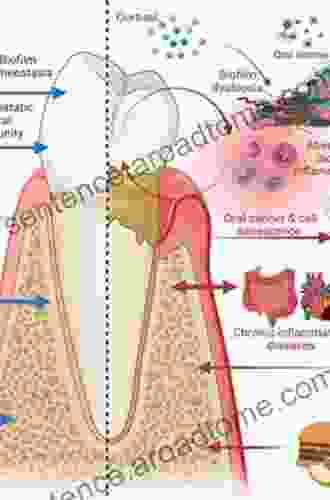 Periodontitis and Systemic Diseases: Clinical Evidence and Biological Plausibility