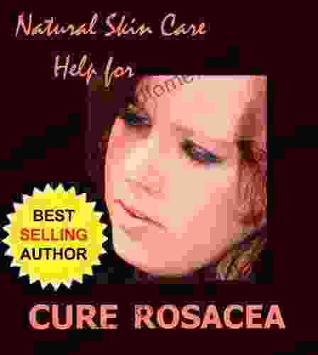 Cure Rosacea New Information Help And Hope For Adult Acne (Natural Skin Care 1)