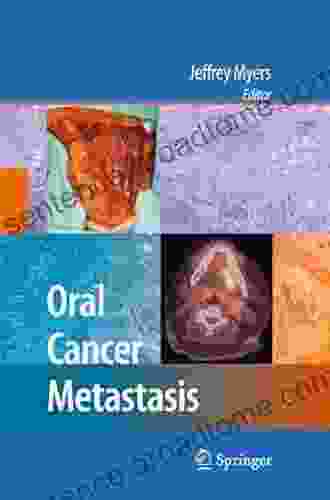 Oral Cancer Metastasis Jeffrey Myers