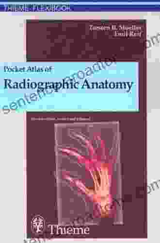 Pocket Atlas Of Radiographic Anatomy: Zus Arb : Torsten B Moller Emil Reif Translated By John Grossman 243 Illustrations